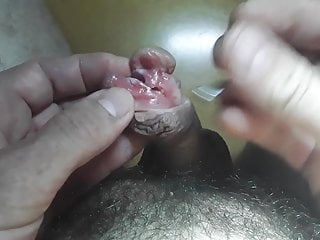 Percipient ve subincision